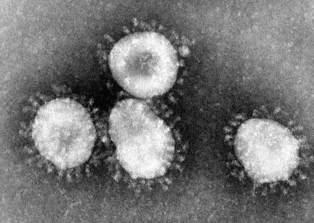 coronavirus - todo lo que hay que saber de wuhan