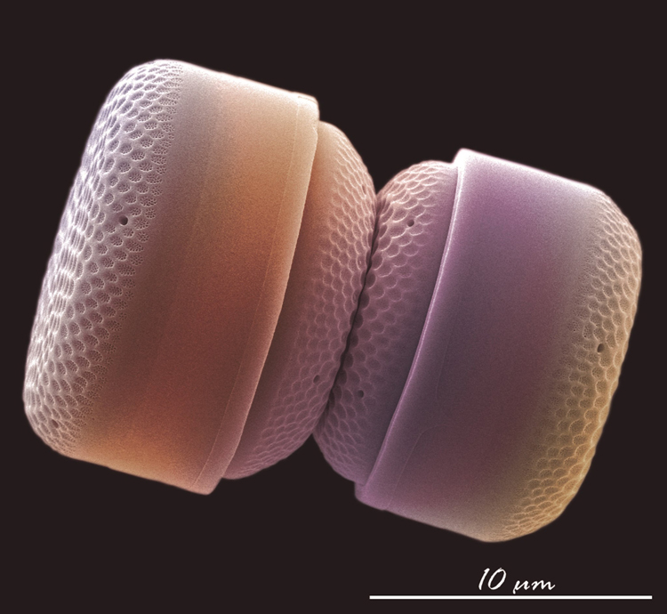 nanoplancton calcareo FOTCIENCIA
