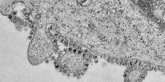 coronavirus