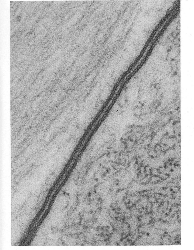 membrana celular al microscopio electrónico
