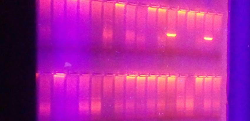 electroforesis donde se ven los resultados de la PCR