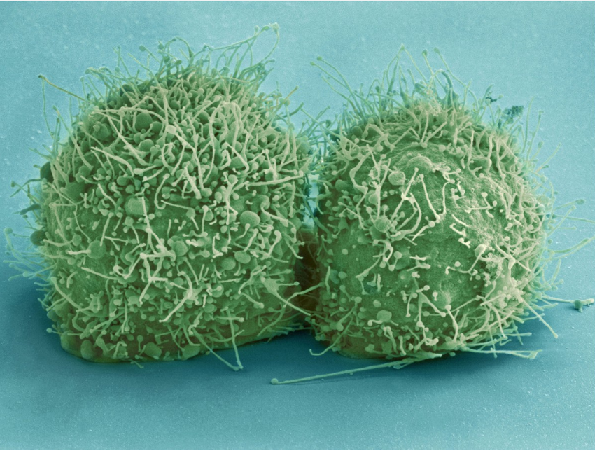 células hela con microscopio de barrido de cultivo celular