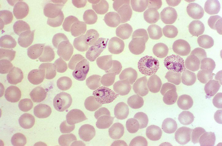 células infestadas por malaria debido al mosquito Anopheles